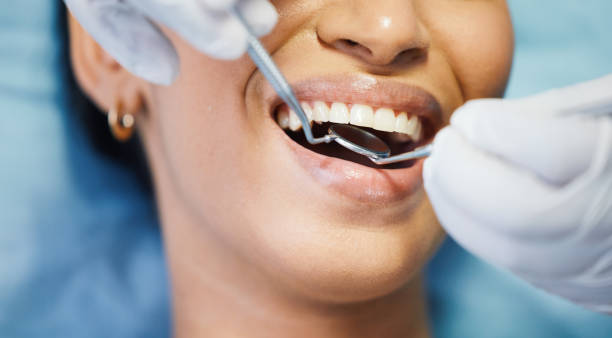Best Knocked-Out Tooth (Avulsed Tooth) Treatment in Churchill, PA